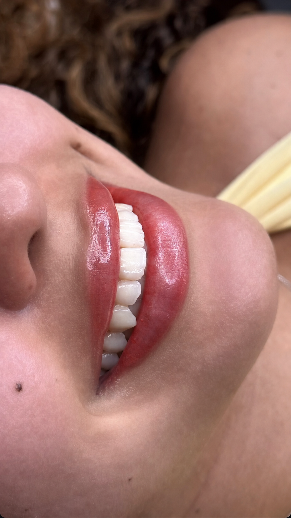 Resultado de Micropigmentação Labial